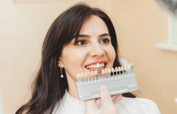 Veneers